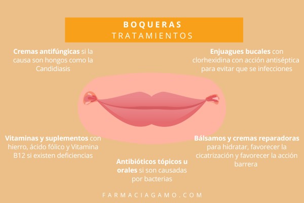 tratamientos boqueras farmacia